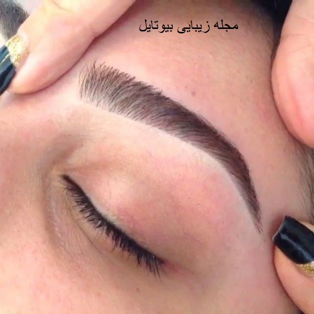 لیفت ابرو