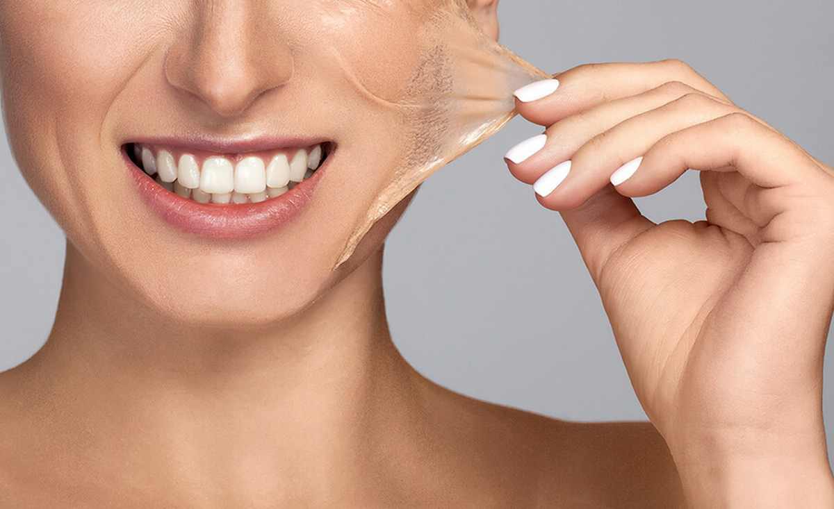 لایه برداری شیمیایی پوست