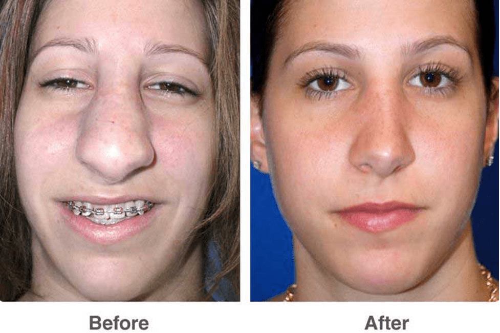 PlasticSurgery