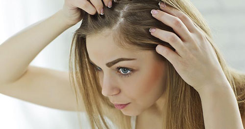 Girl check dandruff
