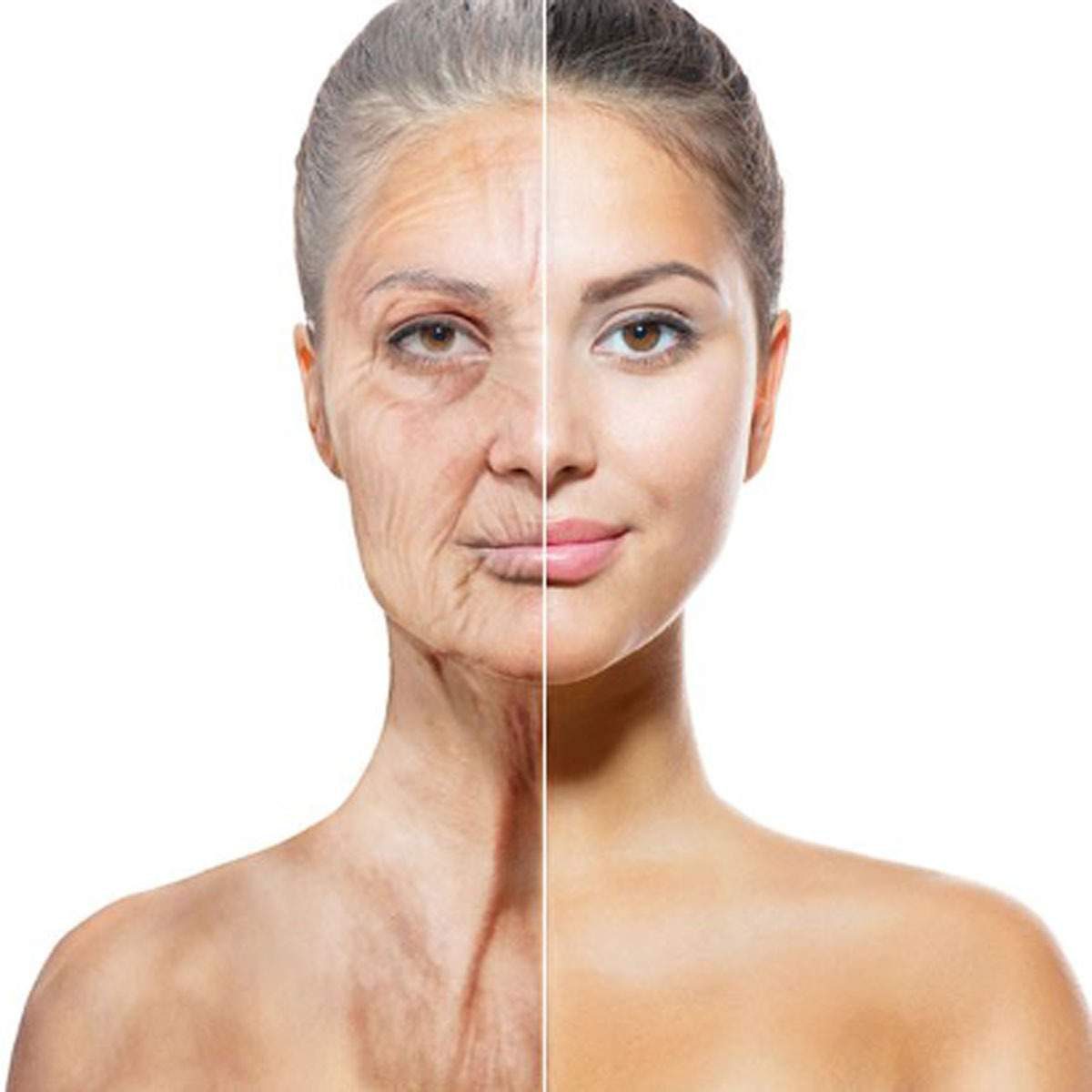 عکس تزئینی هایفوتراپی ۱