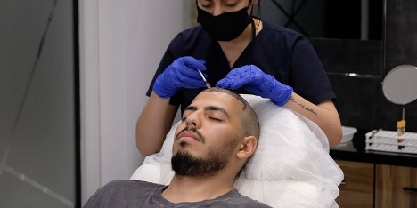 تاثیر مزوتراپی بر مو