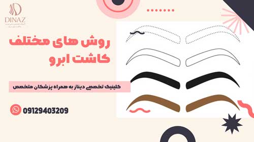 روش های مختلف کاشت ابرو