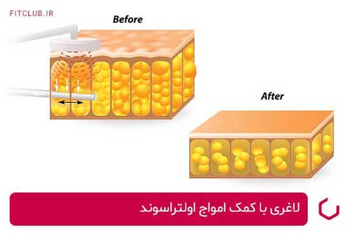 نحوه کار دستگاه کویتیشن