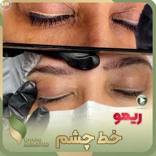 ریمو خط چشم