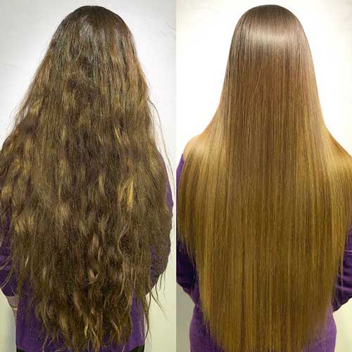 hair restoration1