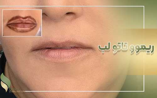 ریمو و تاتو لب
