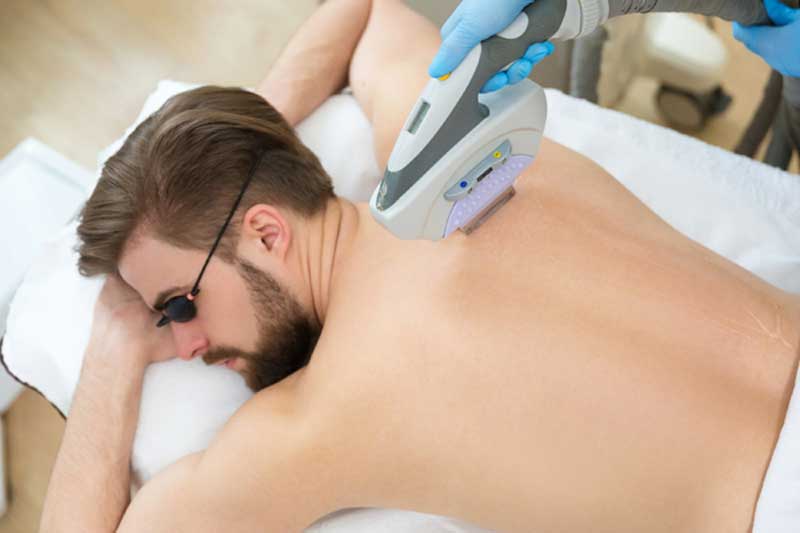laser type3