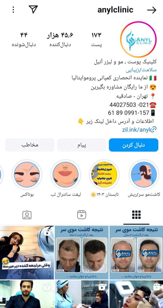 مرکز خدمات میکرونیدلینگ آنیل