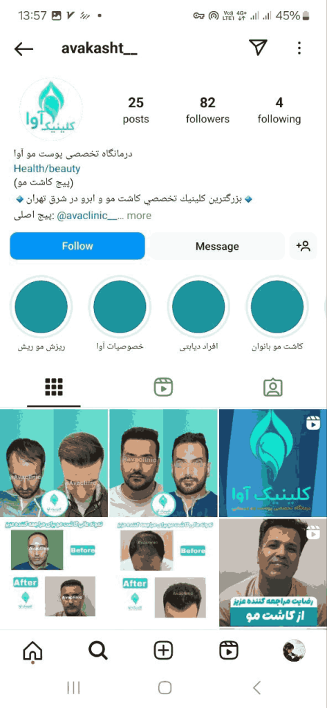 کلینیک کاشت مو آوا درما